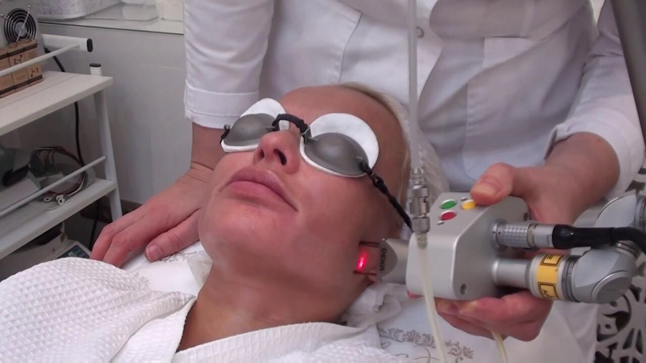 Traitement par faisceau laser sur les zones problématiques de la peau du visage
